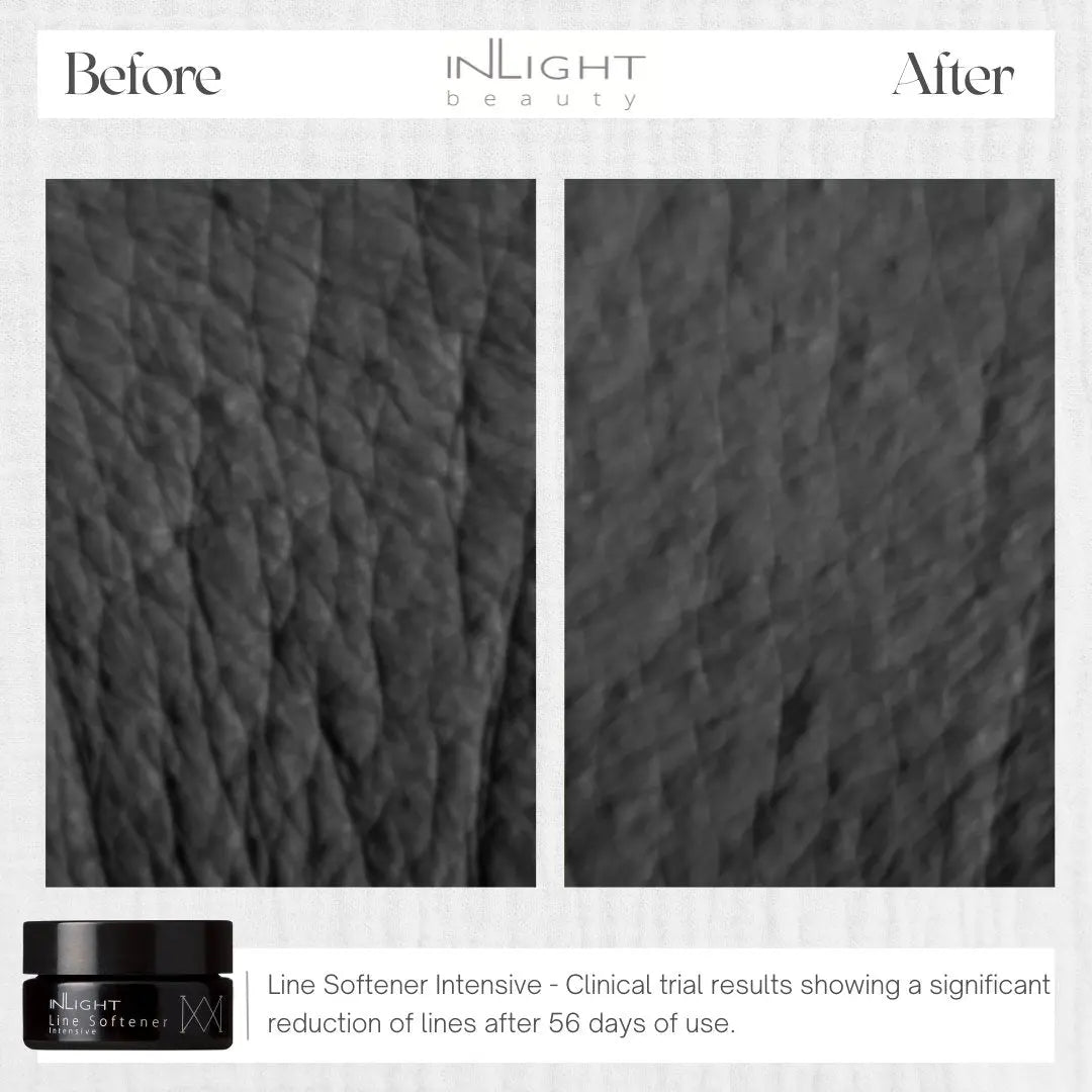 Line Softener Intensive 15ml Inlight Beauty