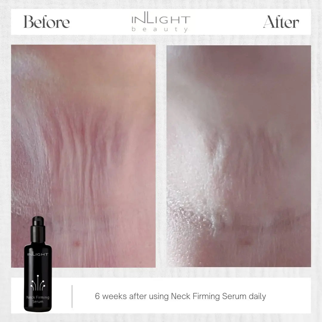 Neck Firming Serum 50ml Inlight Beauty